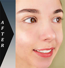 Photoediting, Lejla Bajrami, Graphic and Web Designer